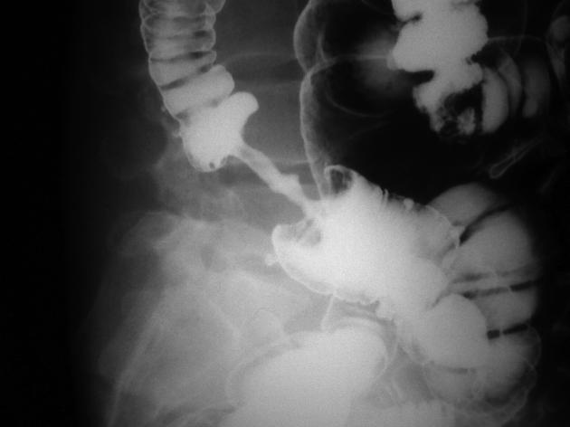 Clinical image for this question