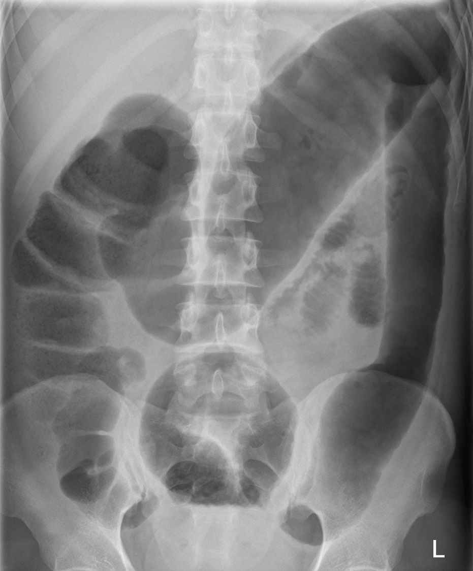 Clinical image for this question