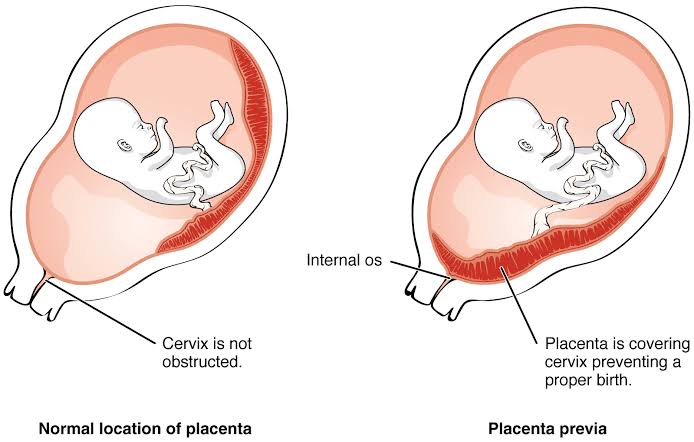Clinical image for this question